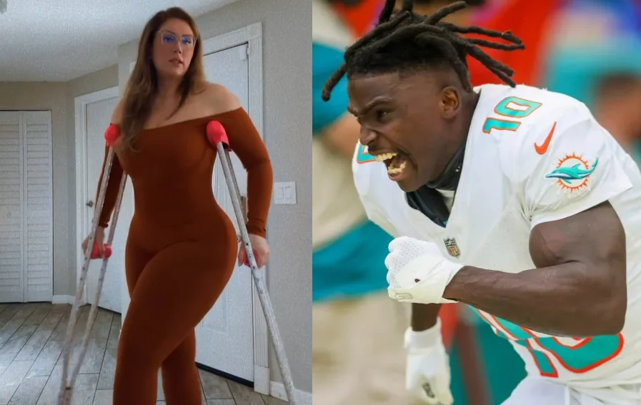 Modelo de OnlyFans demanda a estrella de la NFL por fracturarle una pierna